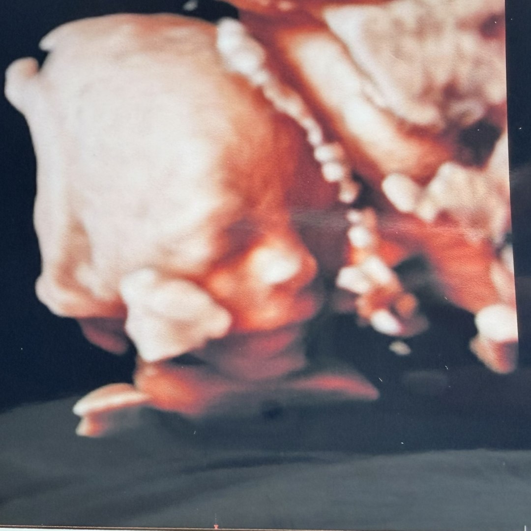 Photo shared by Siobhan for their Babylist baby registry.
