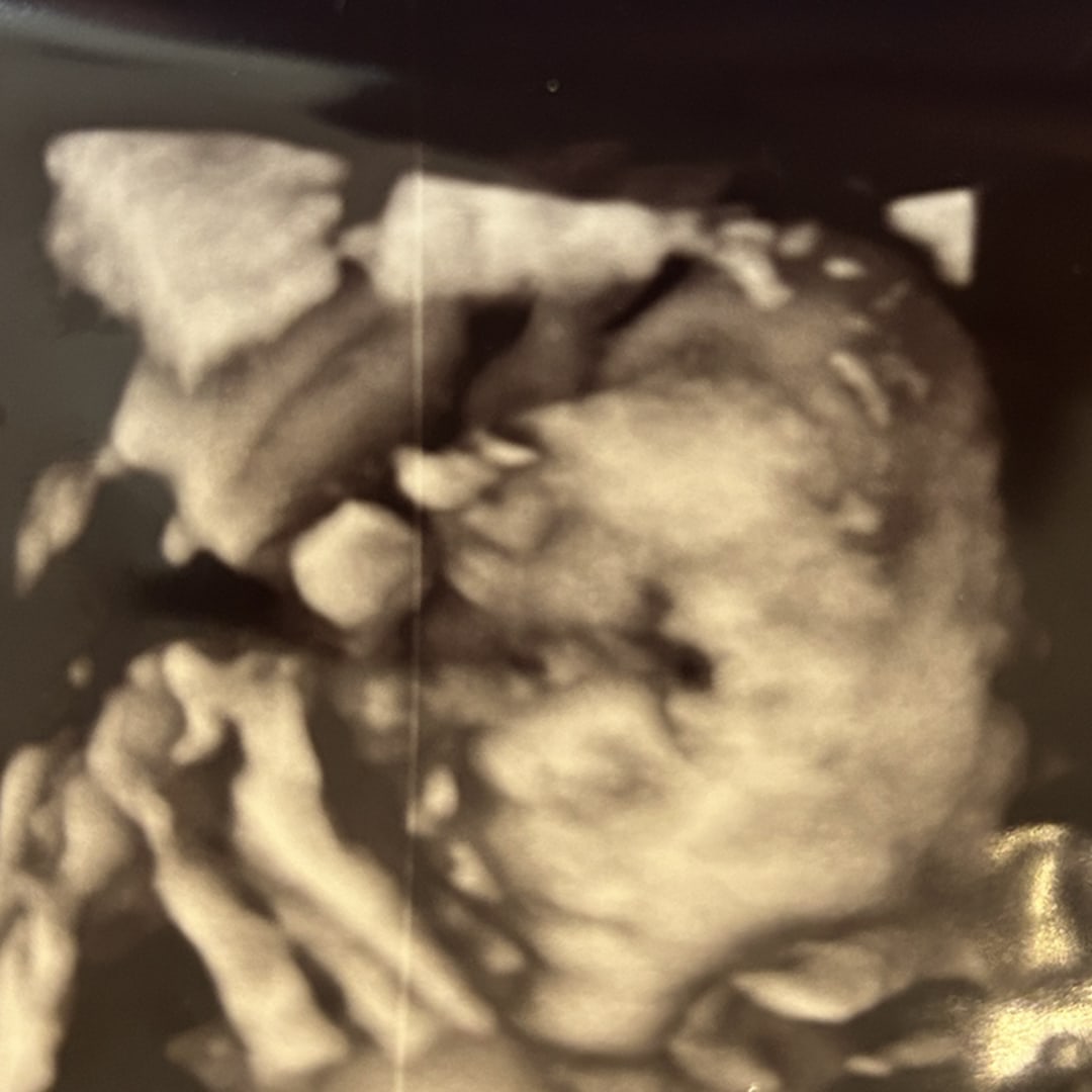 Photo shared by Holly for their Babylist baby registry.