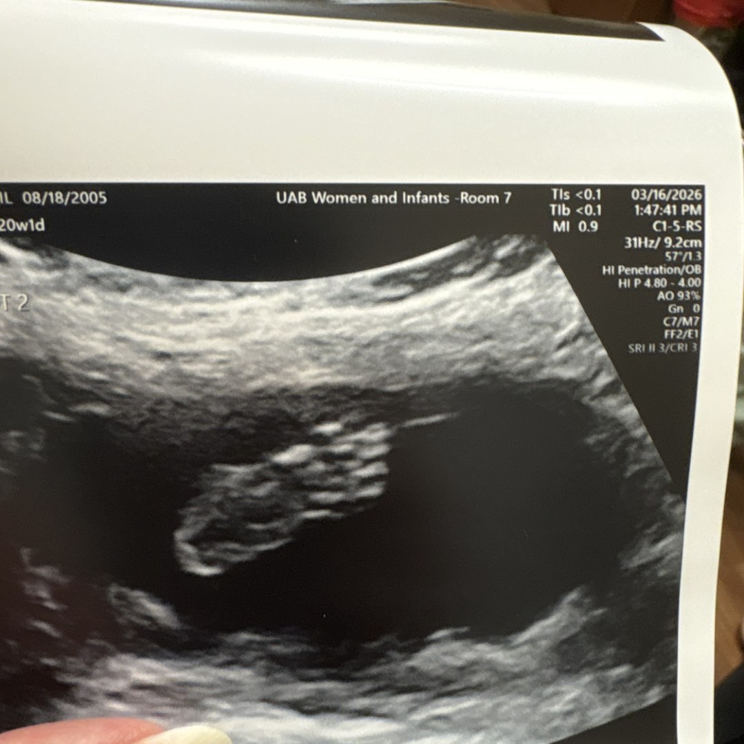 Photo shared by Abigail for their Babylist baby registry.