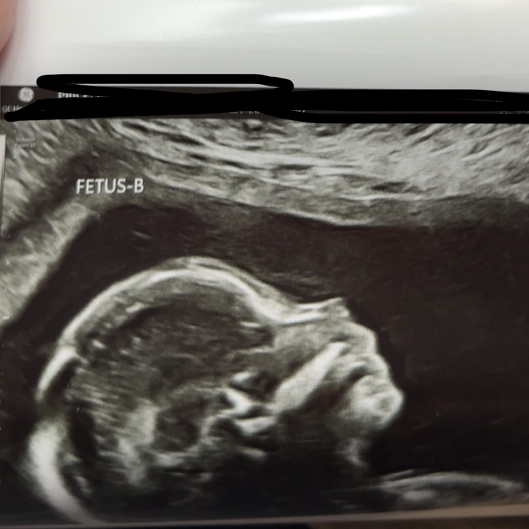 Photo shared by Jade for their Babylist baby registry.