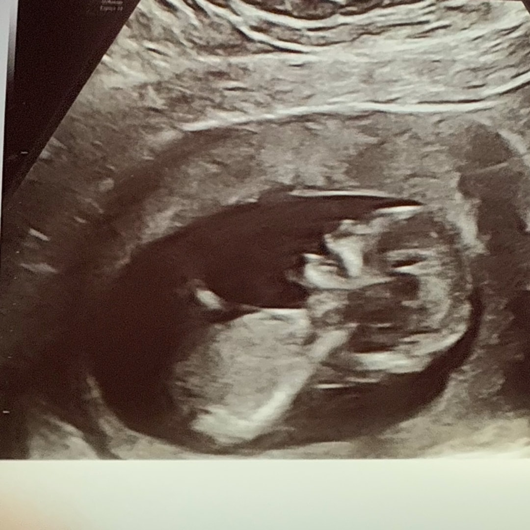 Photo shared by Julia for their Babylist baby registry.