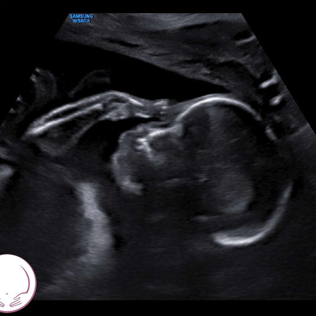 Photo shared by Erika for their Babylist baby registry.