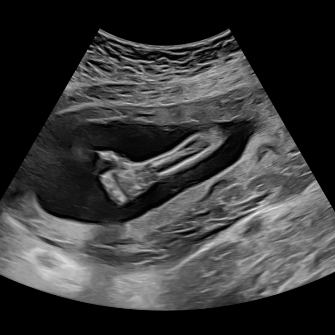 Photo shared by Hannah for their Babylist baby registry.
