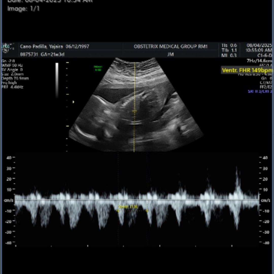 Photo shared by Yajaira for their Babylist baby registry.