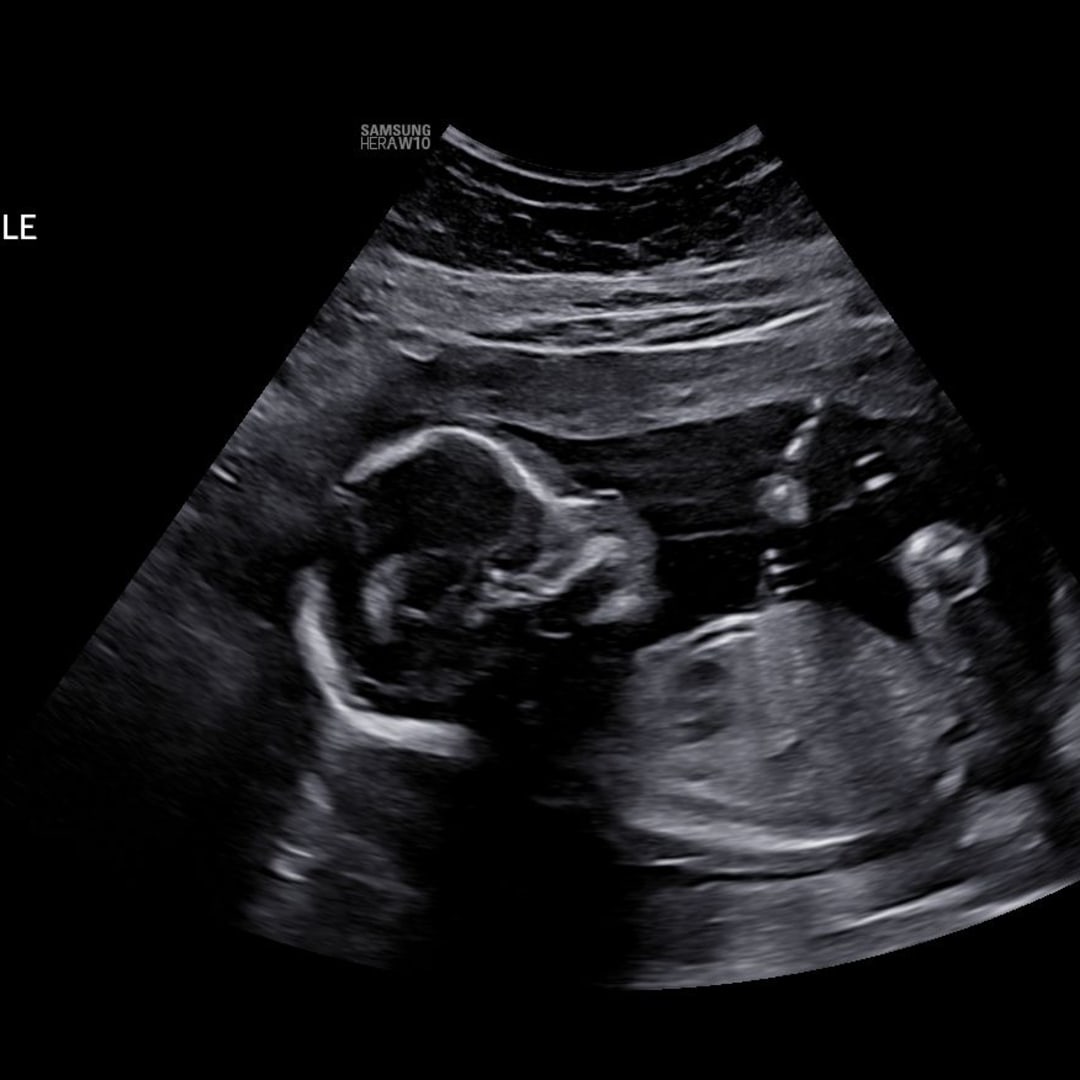 Photo shared by Savannah for their Babylist baby registry.