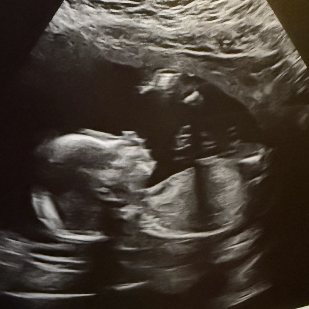Photo shared by Christie for their Babylist baby registry.