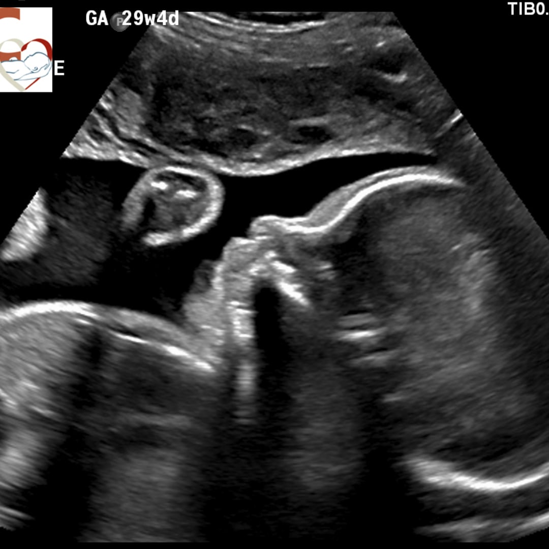 Photo shared by Daishyana for their Babylist baby registry.