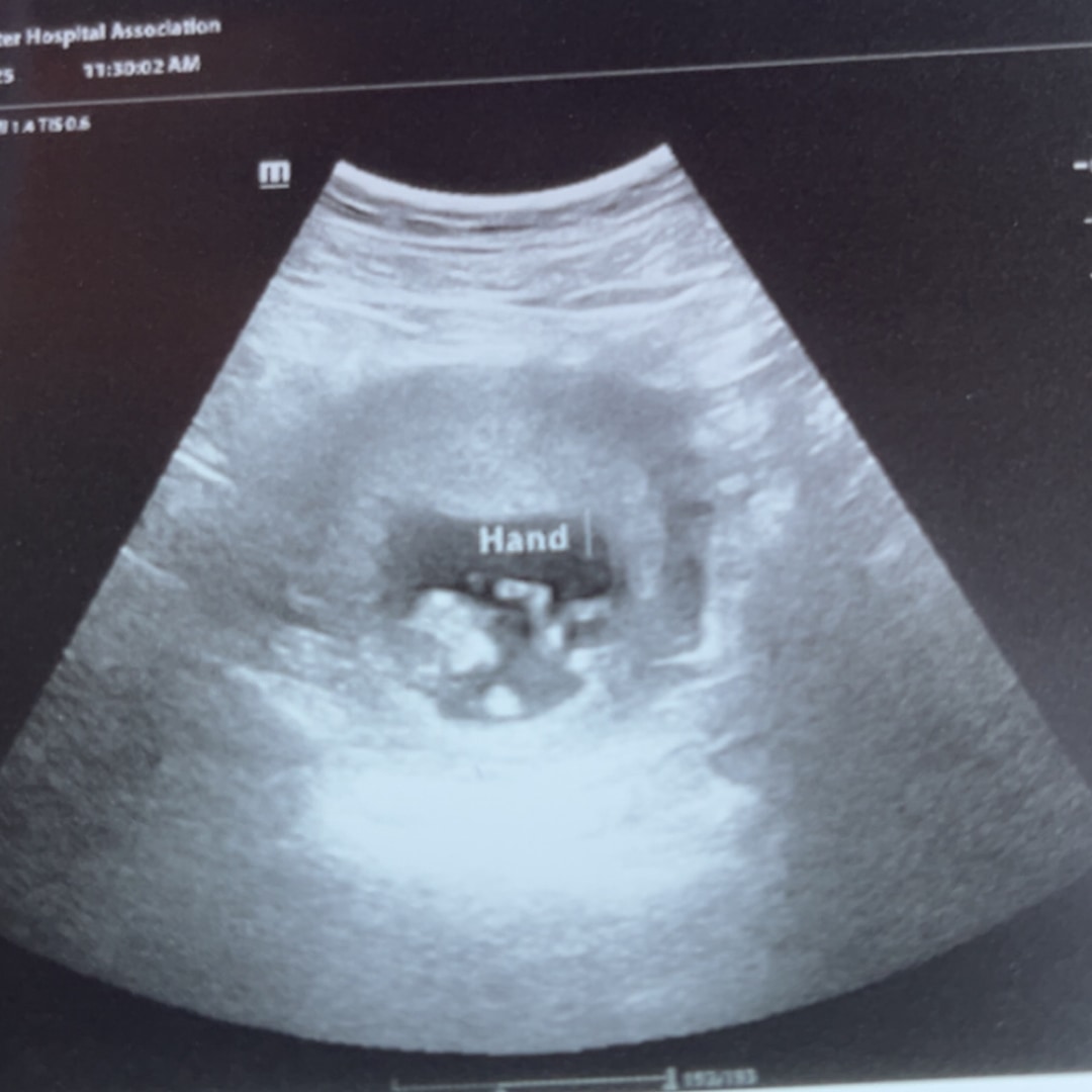 Photo shared by Kira for their Babylist baby registry.