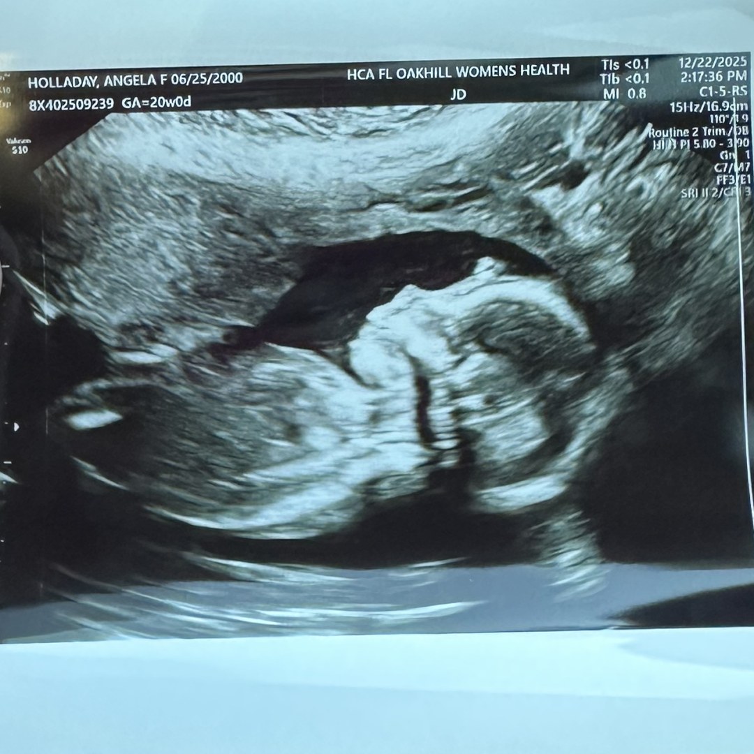 Photo shared by Angela for their Babylist baby registry.