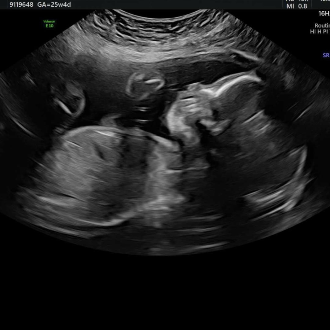 Photo shared by Jasmin for their Babylist baby registry.