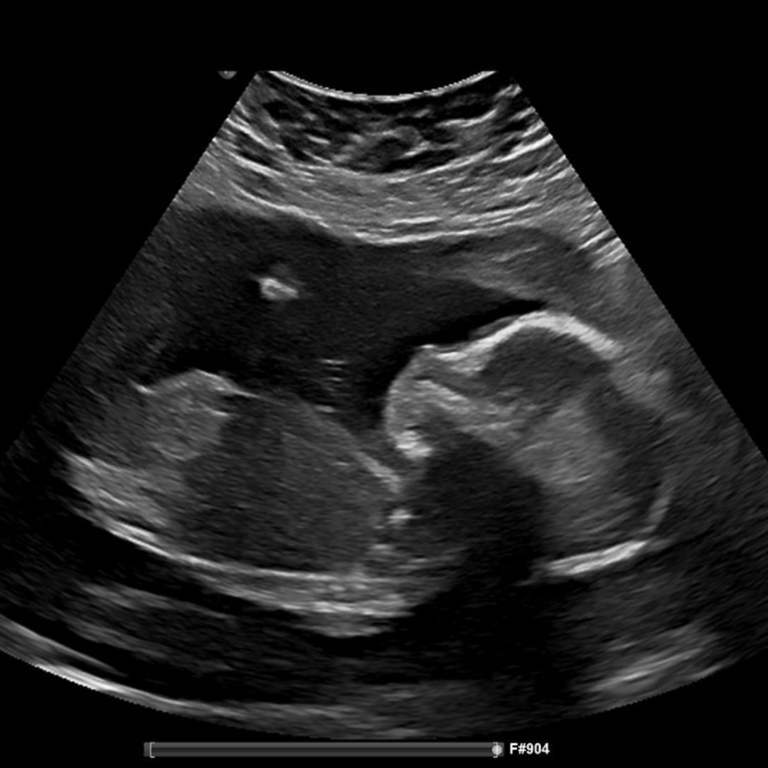 Photo shared by Laura for their Babylist baby registry.