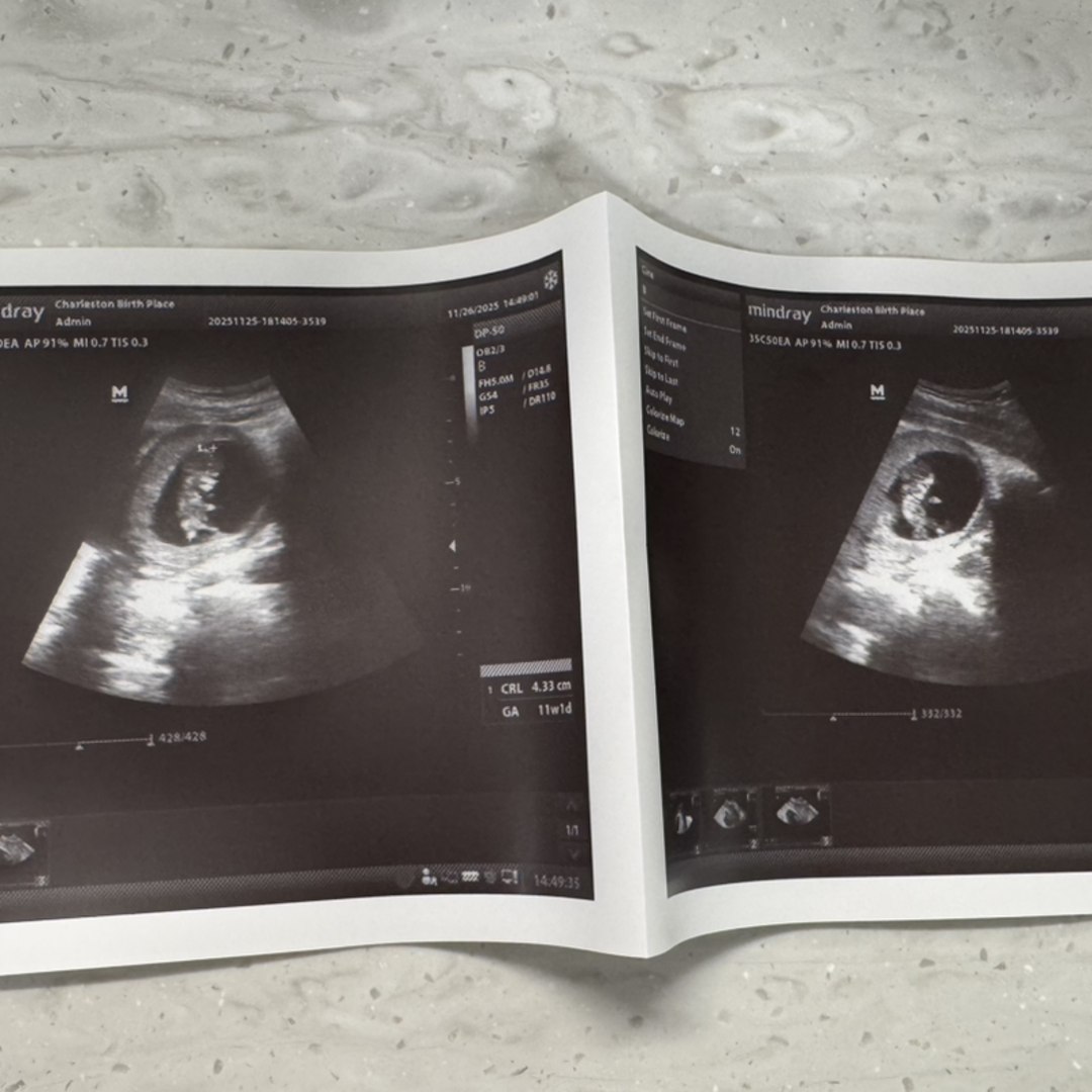 Photo shared by Hunter for their Babylist baby registry.