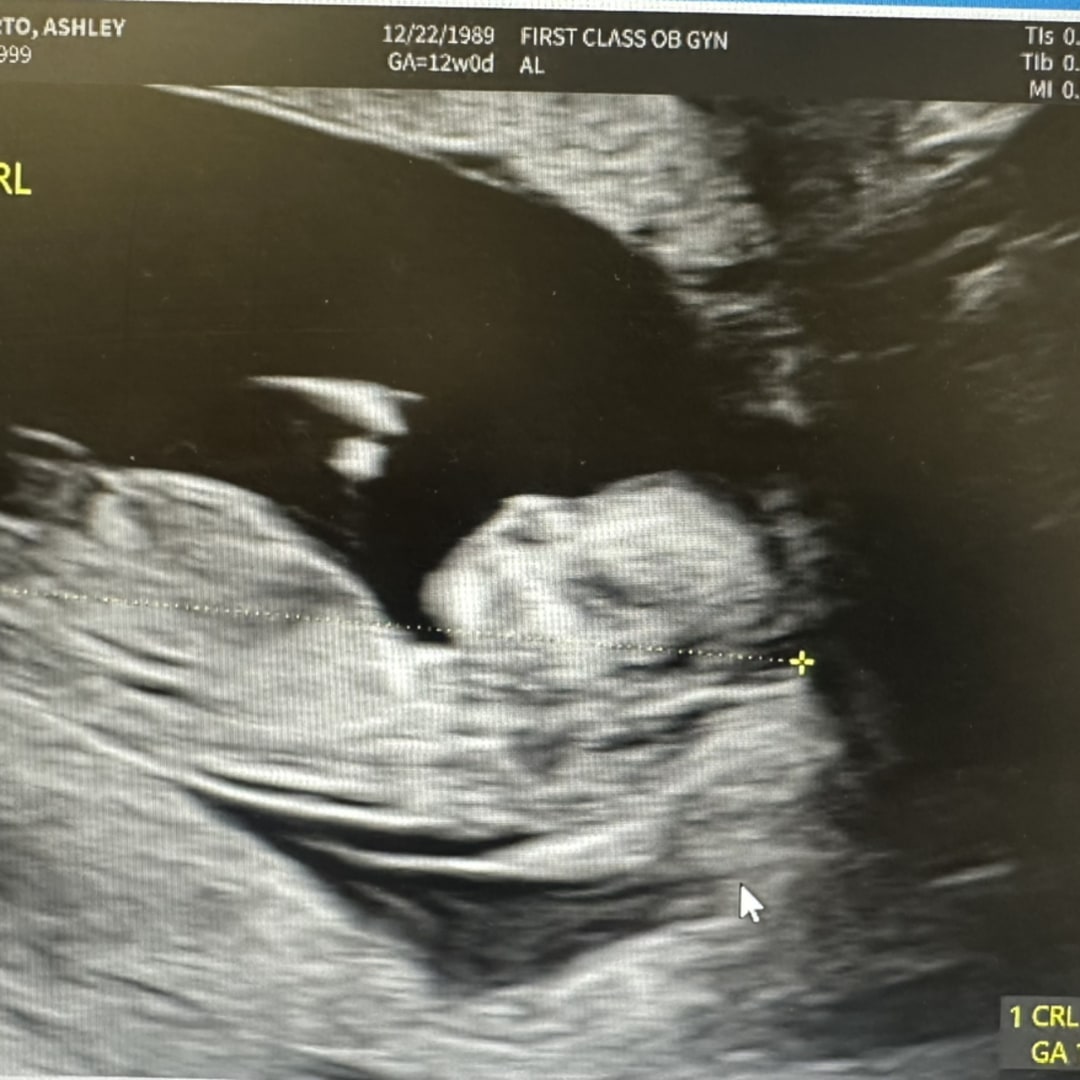 Photo shared by Ashley for their Babylist baby registry.