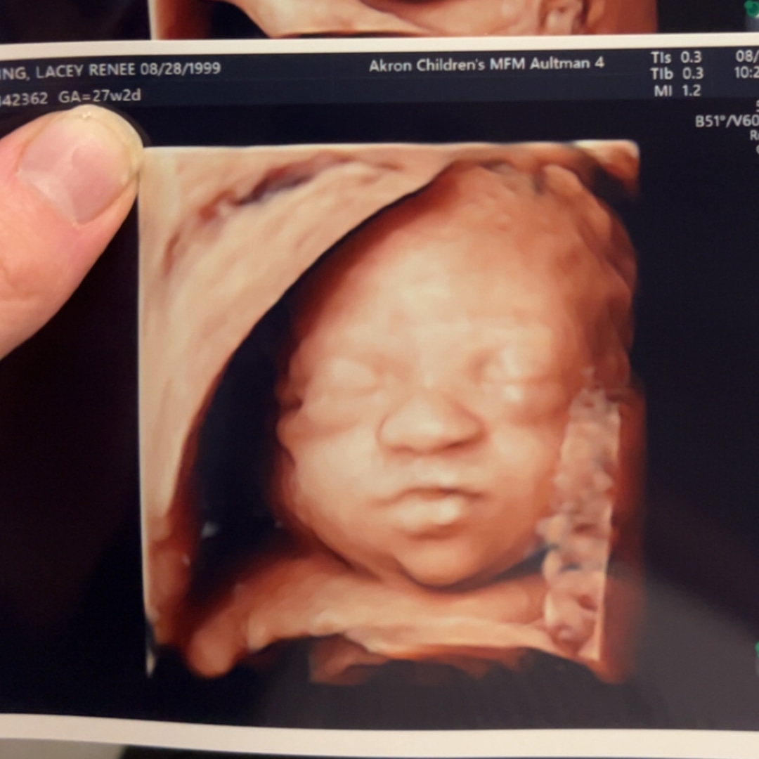 Photo shared by Lacey for their Babylist baby registry.