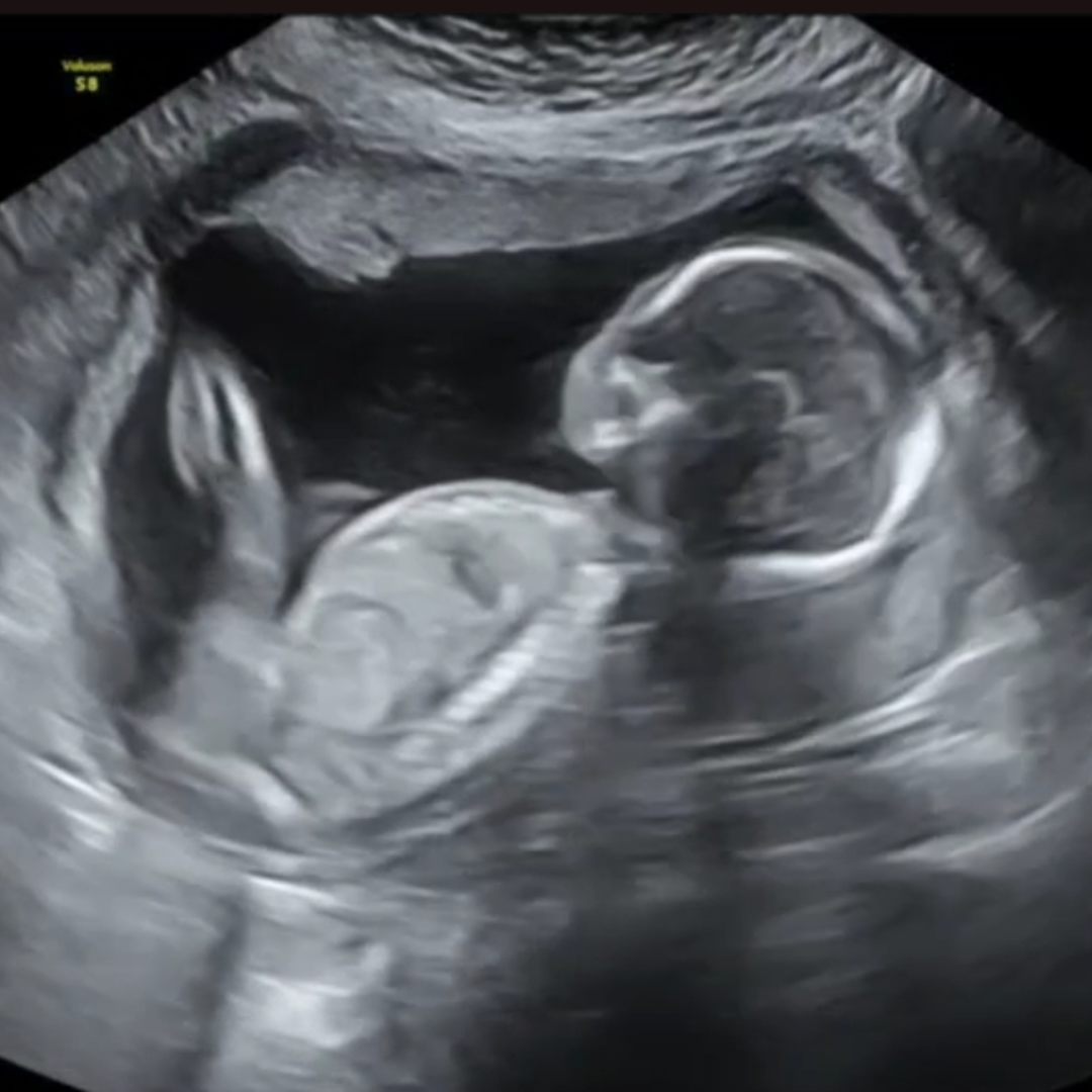 Photo shared by Patrick for their Babylist baby registry.