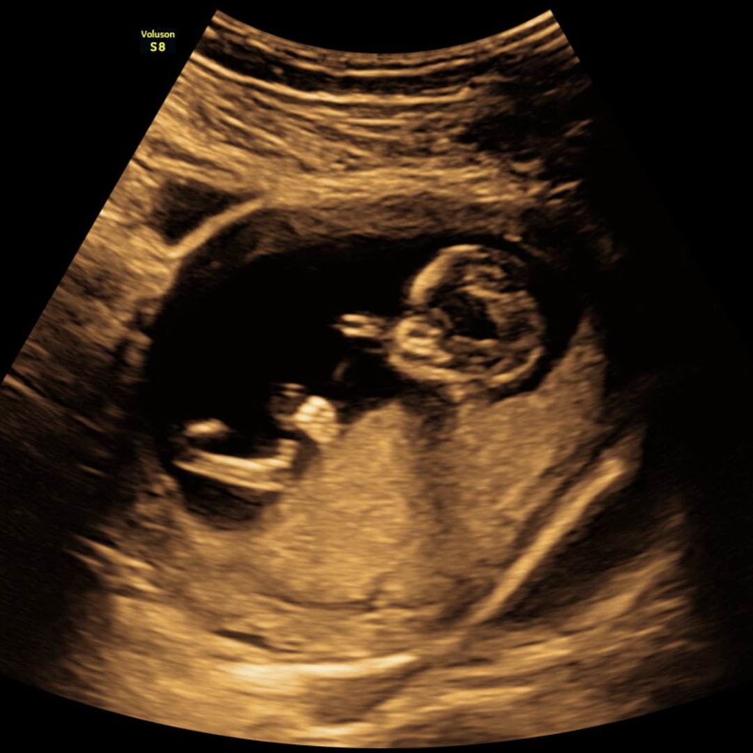 Photo shared by Paige for their Babylist baby registry.