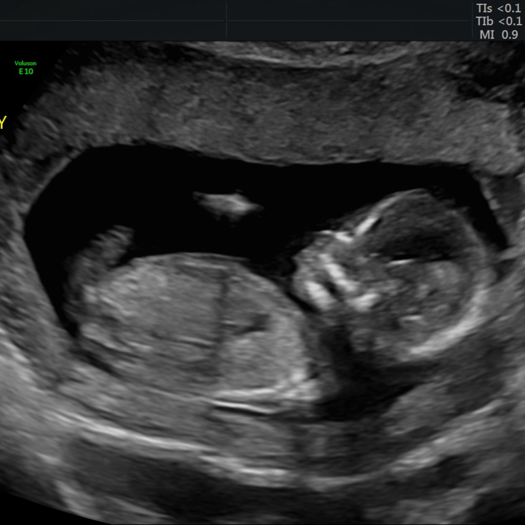 Photo shared by Sierra for their Babylist baby registry.