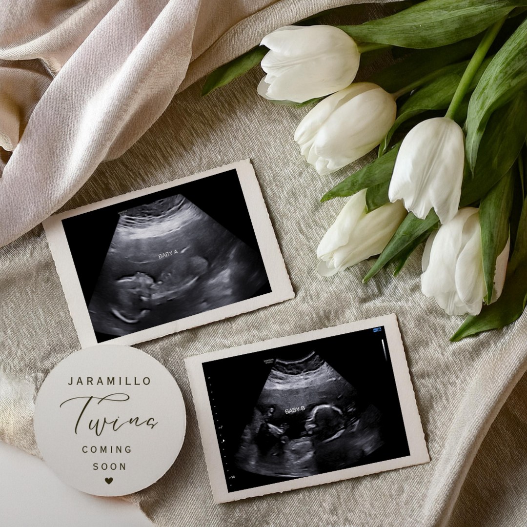 Photo shared by Andrea for their Babylist baby registry.