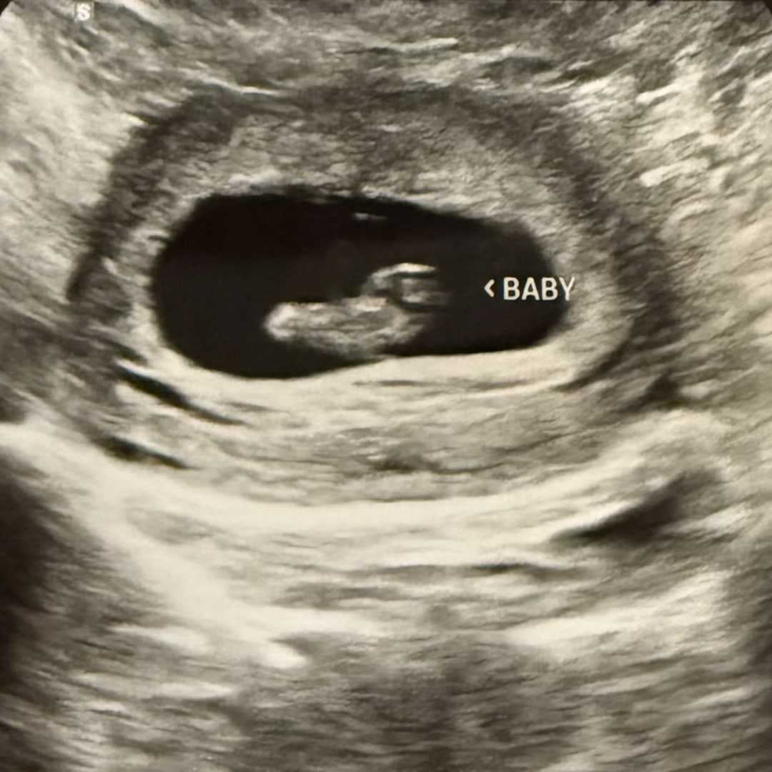 Photo shared by Mariah for their Babylist baby registry.