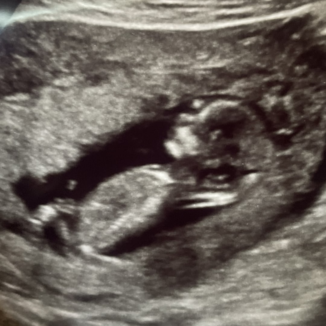 Photo shared by Schiller for their Babylist baby registry.