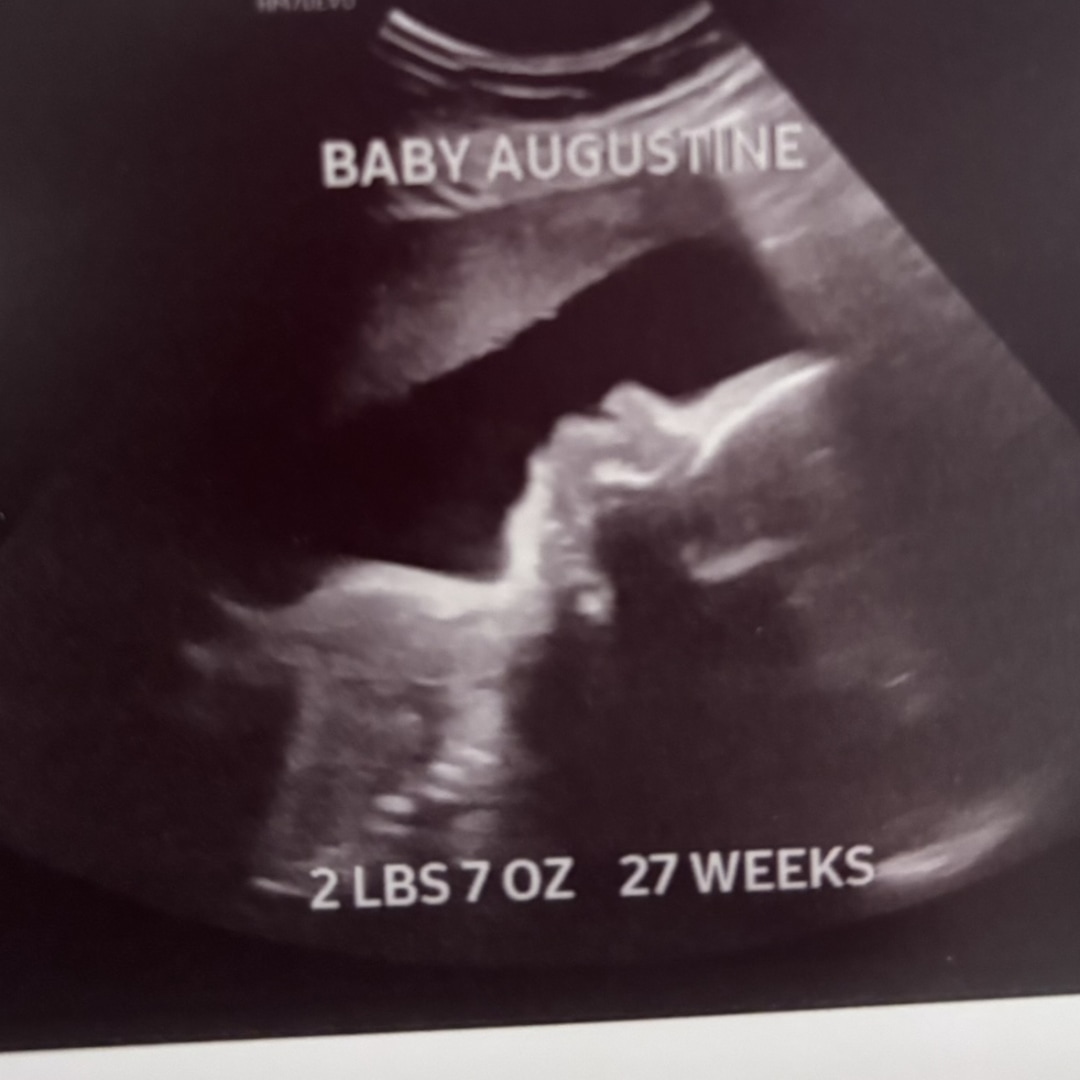 Photo shared by Carla for their Babylist baby registry.