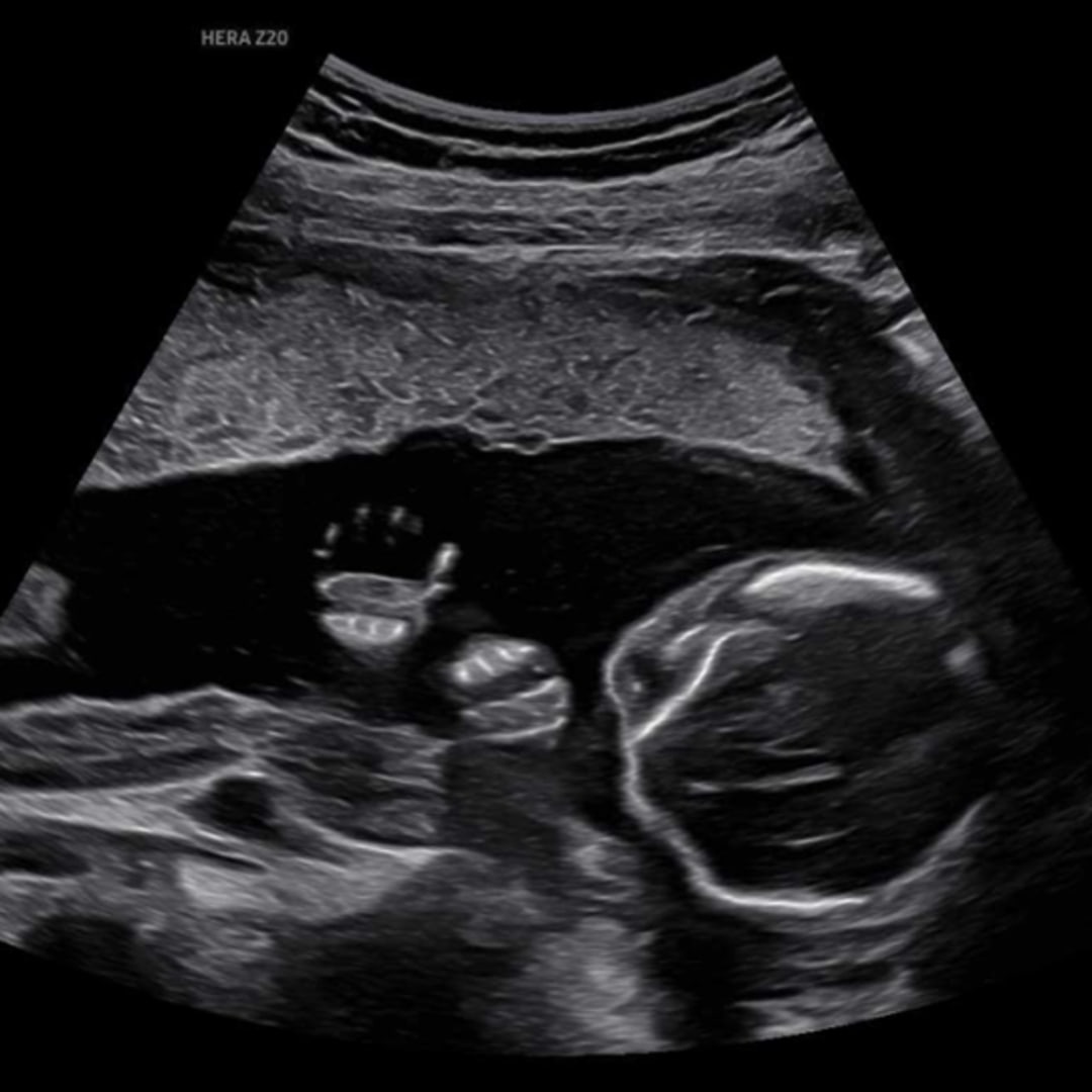 Photo shared by Hannah for their Babylist baby registry.