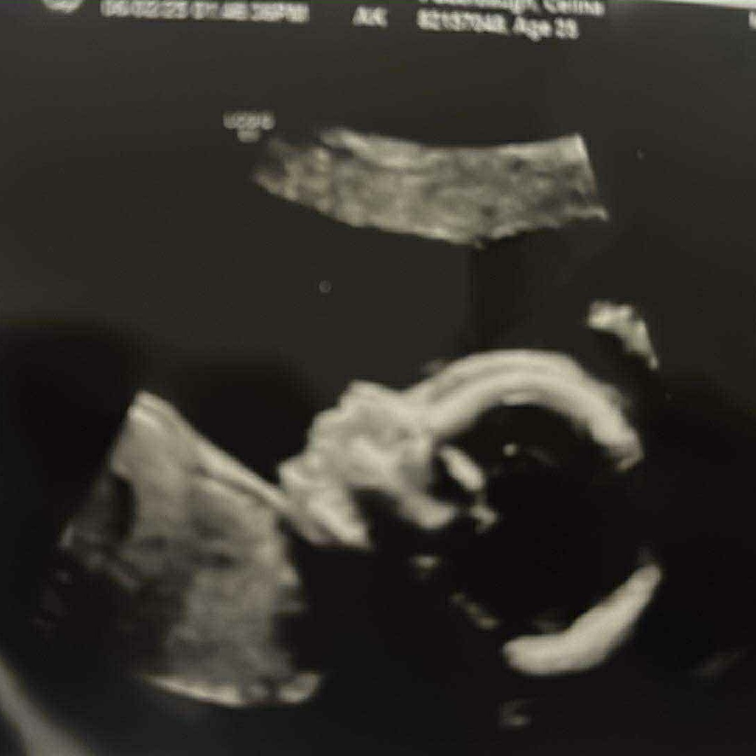 Photo shared by Celina for their Babylist baby registry.