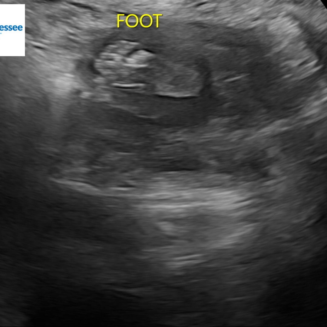 Photo shared by Lillie for their Babylist baby registry.