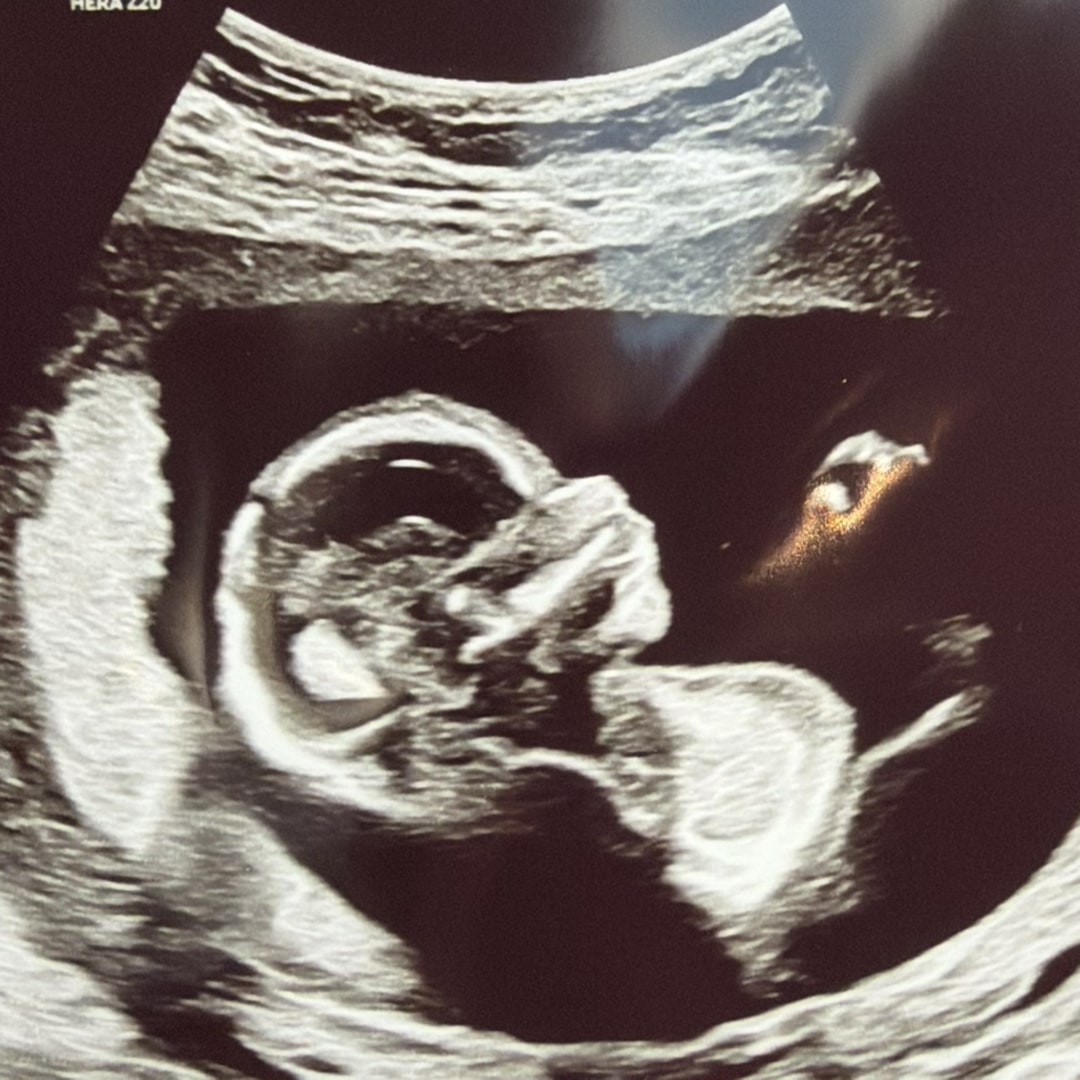 Photo shared by Renee for their Babylist baby registry.