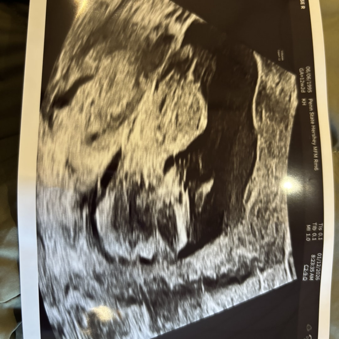 Photo shared by Elise for their Babylist baby registry.