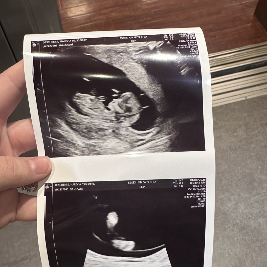 Photo shared by Haley for their Babylist baby registry.