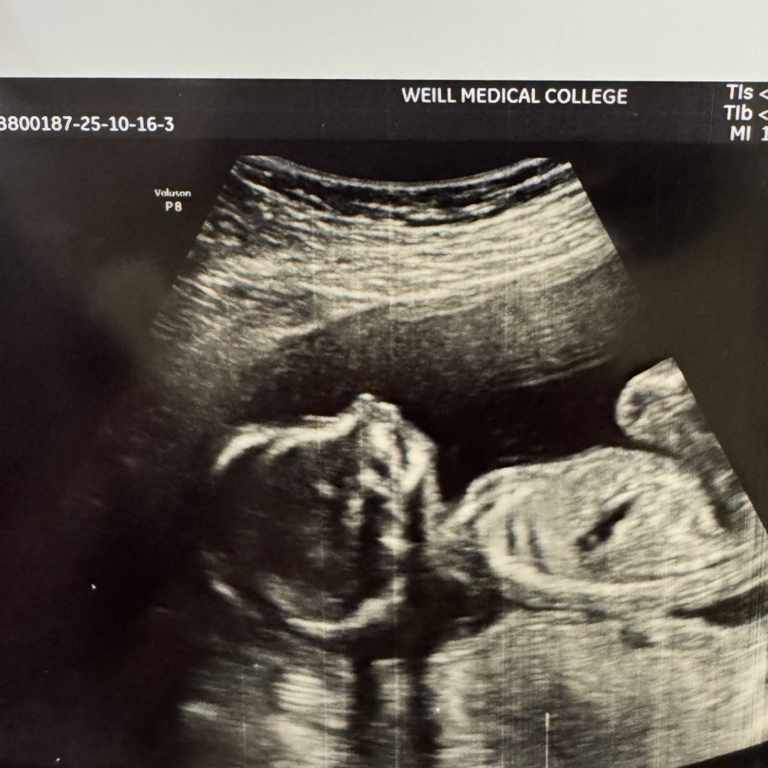 Photo shared by Evan for their Babylist baby registry.