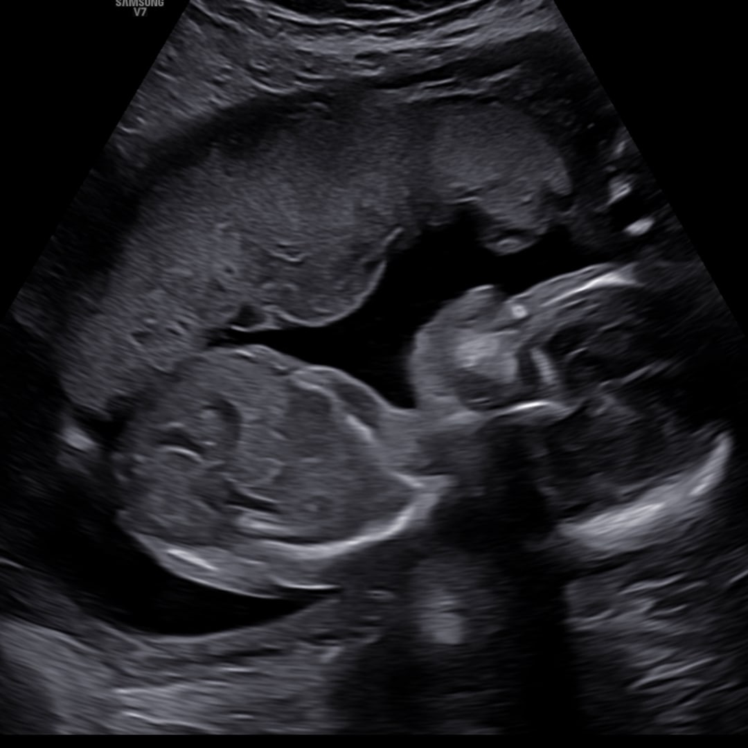 Photo shared by Lily for their Babylist baby registry.