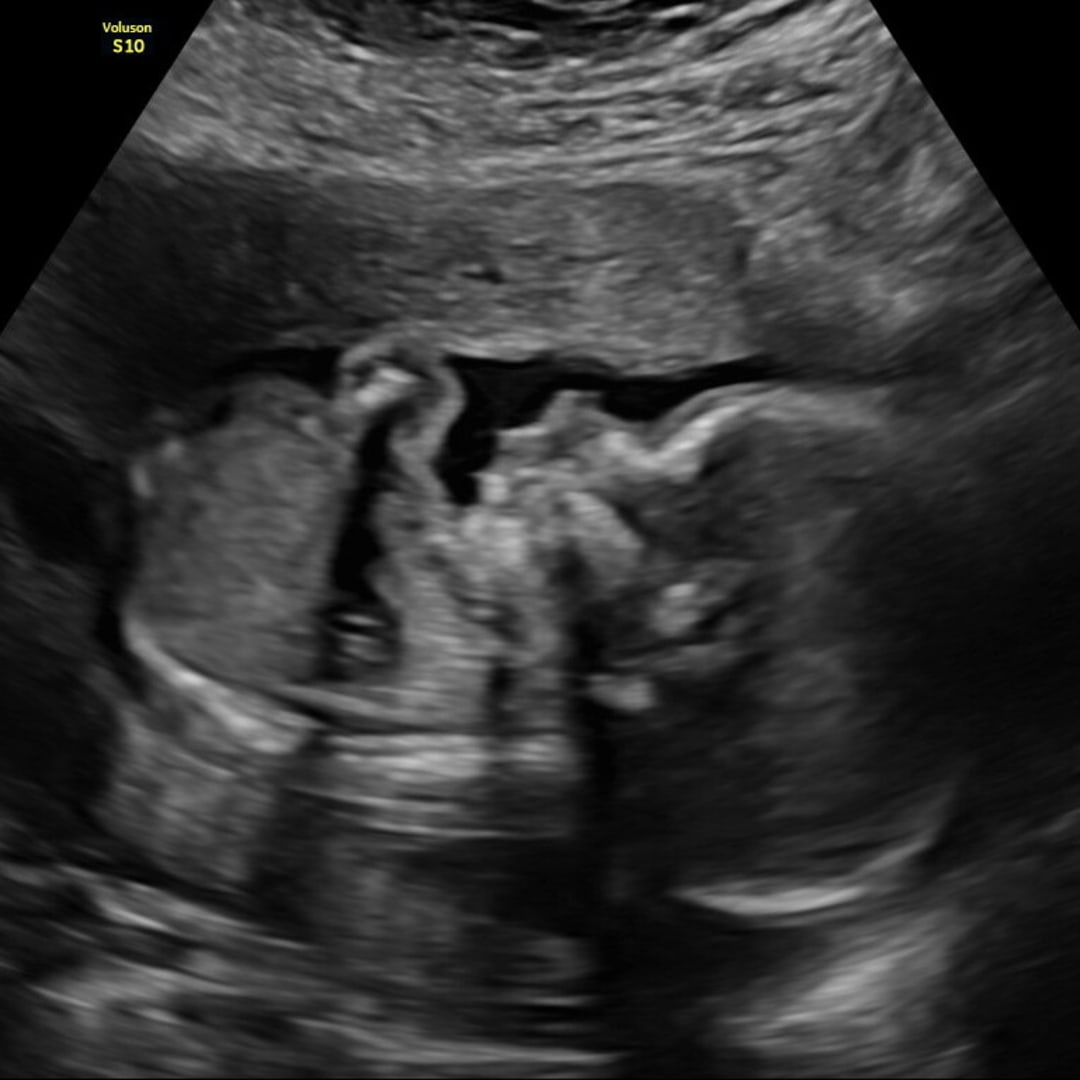 Photo shared by Jessie for their Babylist baby registry.