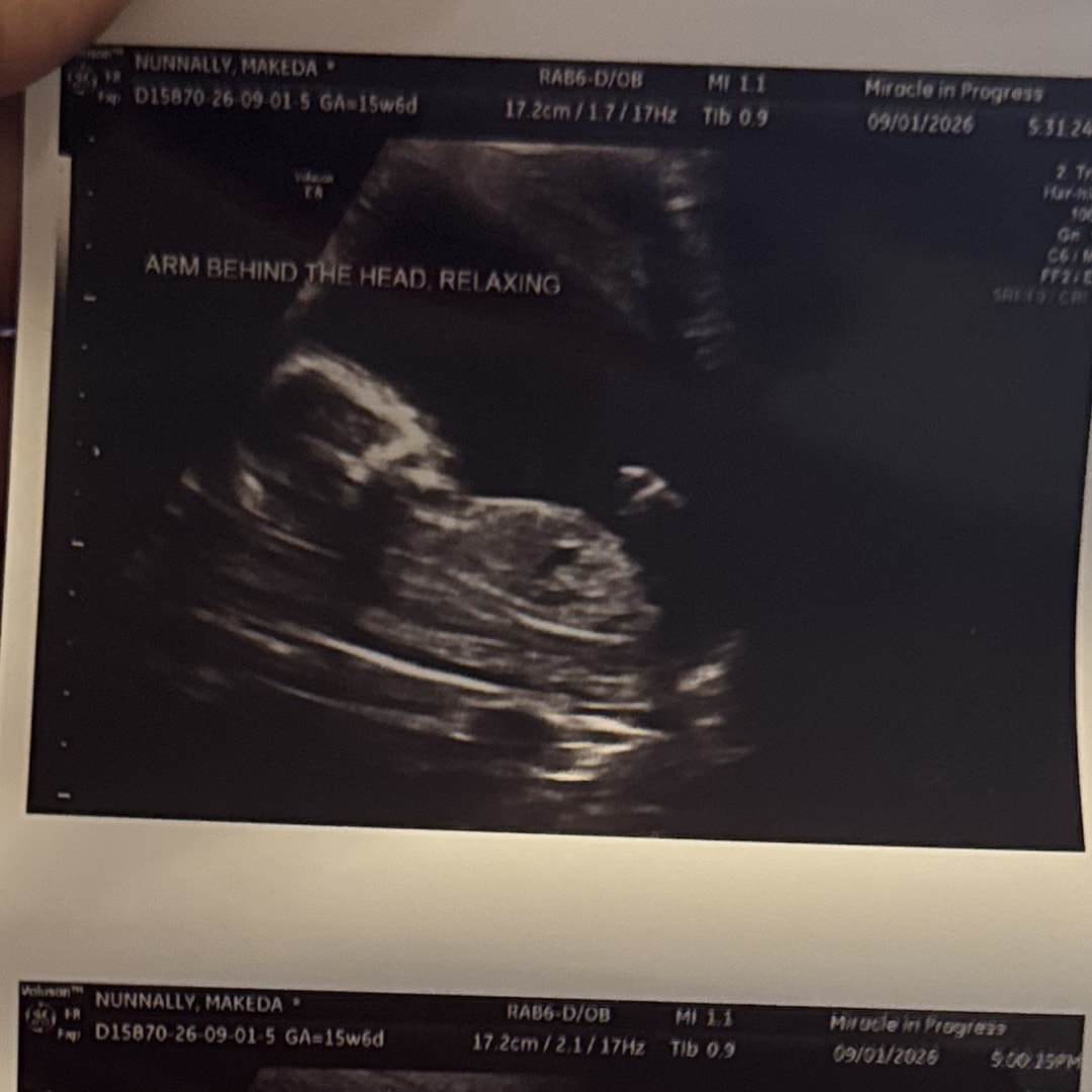 Photo shared by Makeda for their Babylist baby registry.