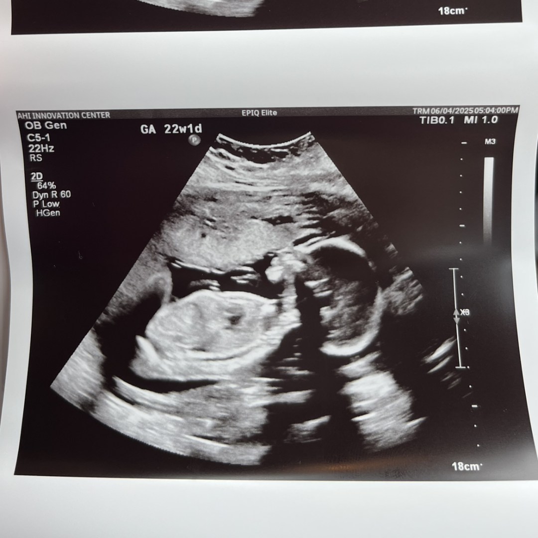 Photo shared by Shannel for their Babylist baby registry.