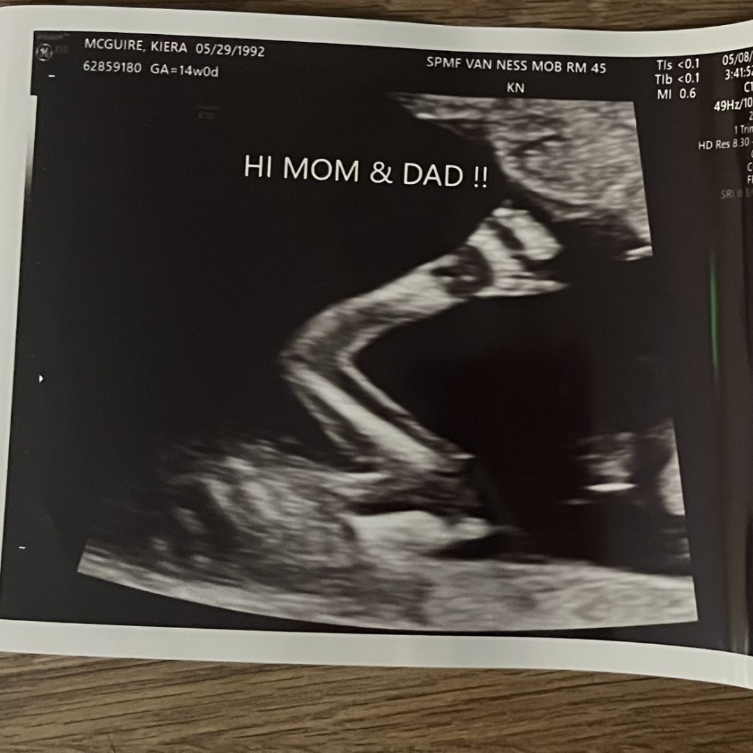 Photo shared by Kiera for their Babylist baby registry.