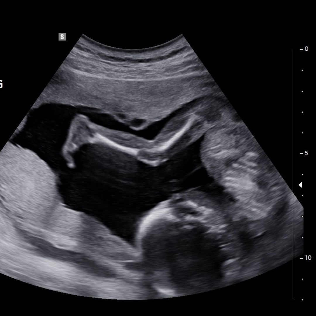 Photo shared by Cassie for their Babylist baby registry.
