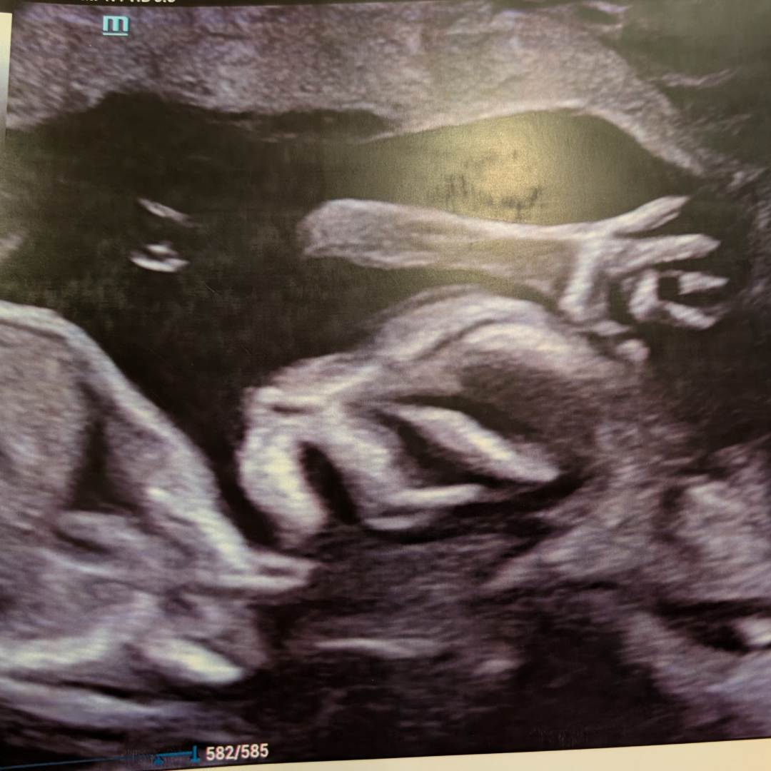 Photo shared by Courtney for their Babylist baby registry.