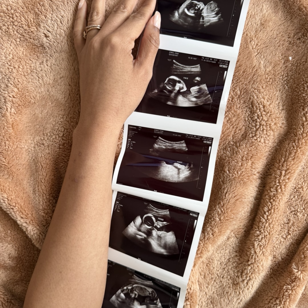 Photo shared by Daja for their Babylist baby registry.