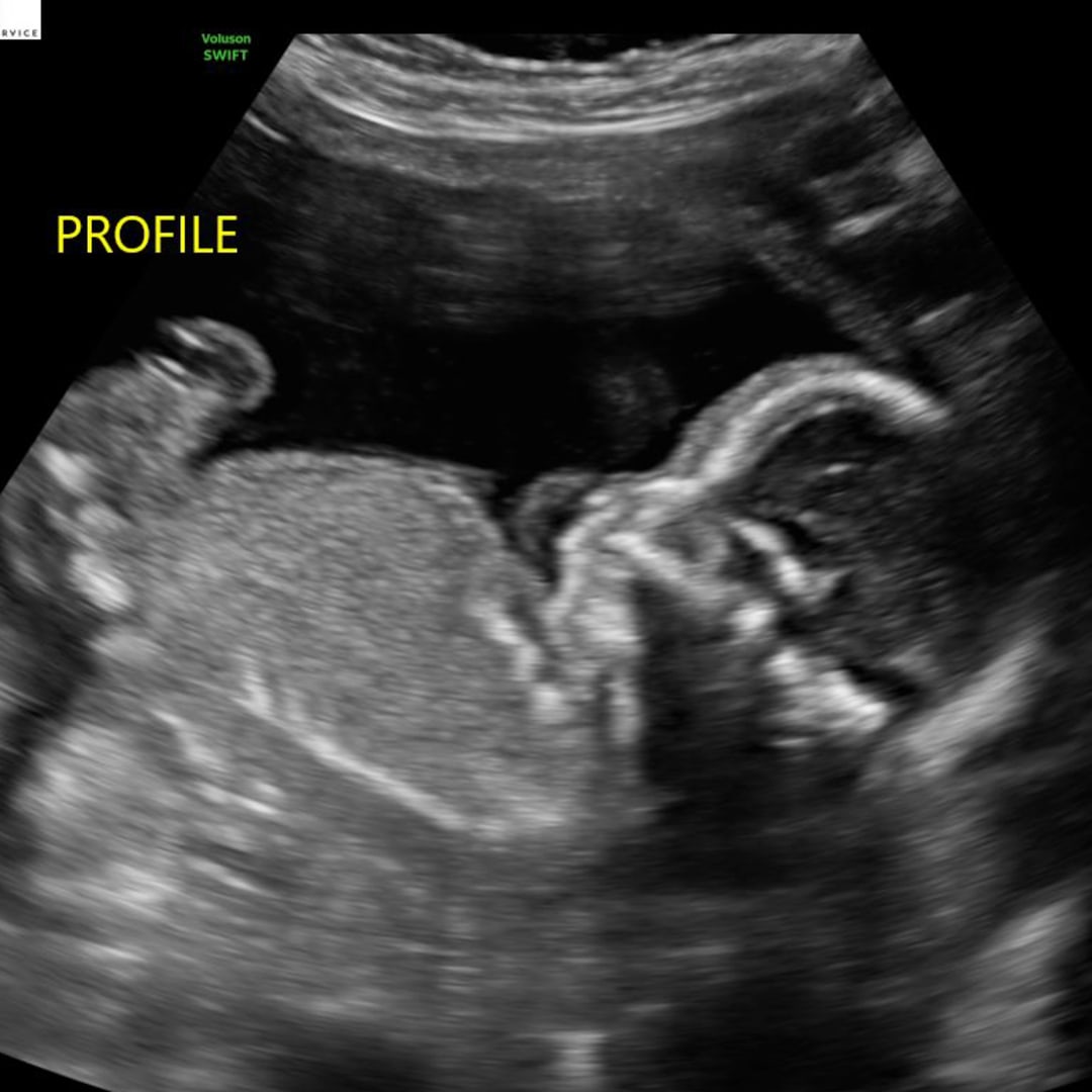 Photo shared by Ashley for their Babylist baby registry.