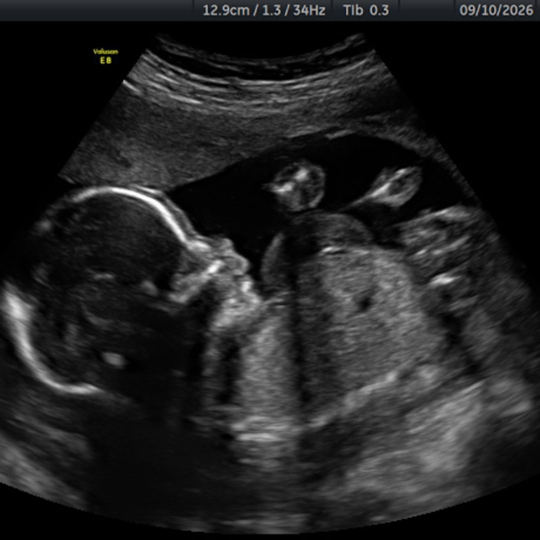 Photo shared by Erika for their Babylist baby registry.