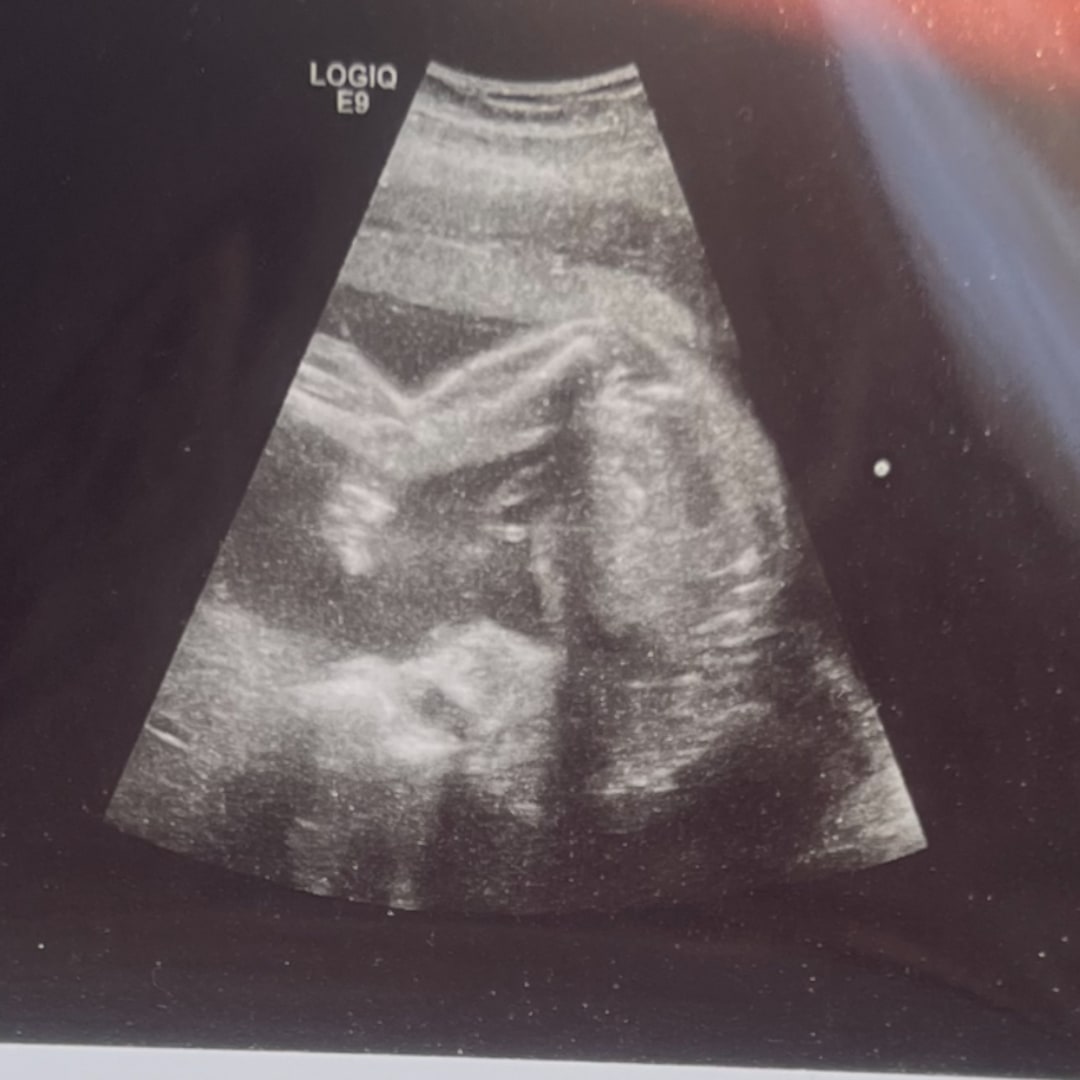 Photo shared by Bianca for their Babylist baby registry.