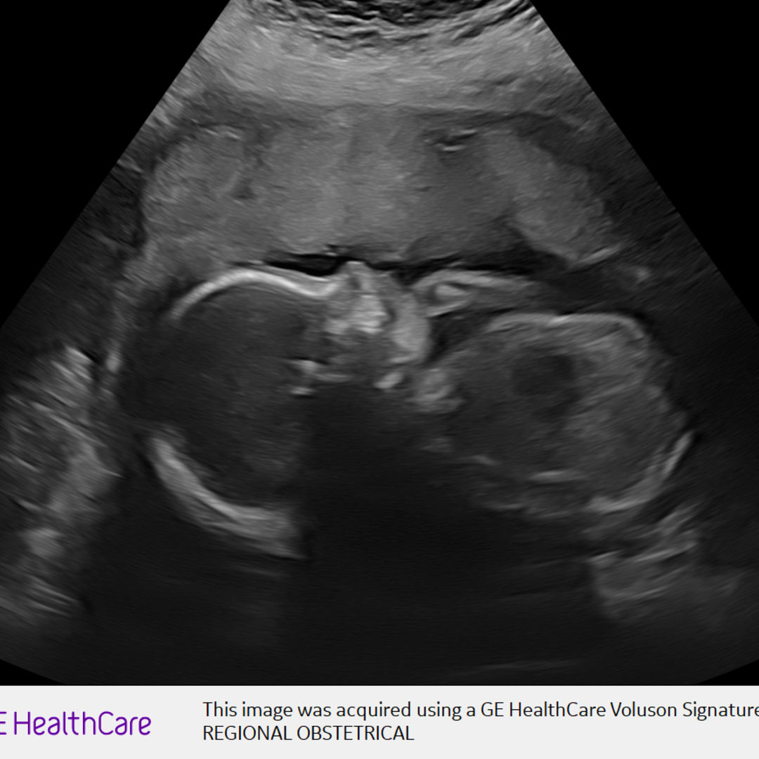 Photo shared by Abbi for their Babylist baby registry.