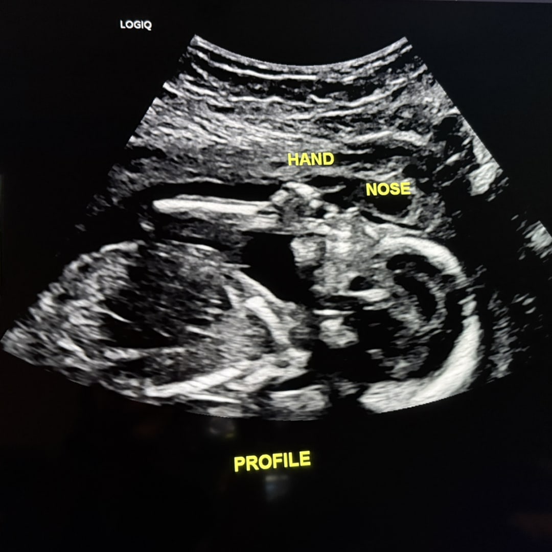 Photo shared by Savannah for their Babylist baby registry.