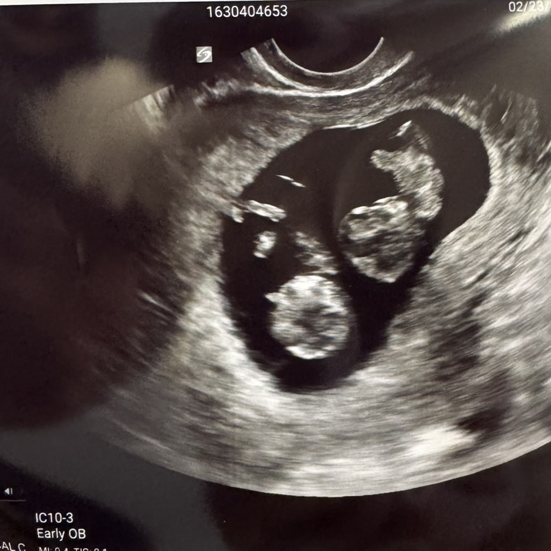 Photo shared by Grace for their Babylist baby registry.