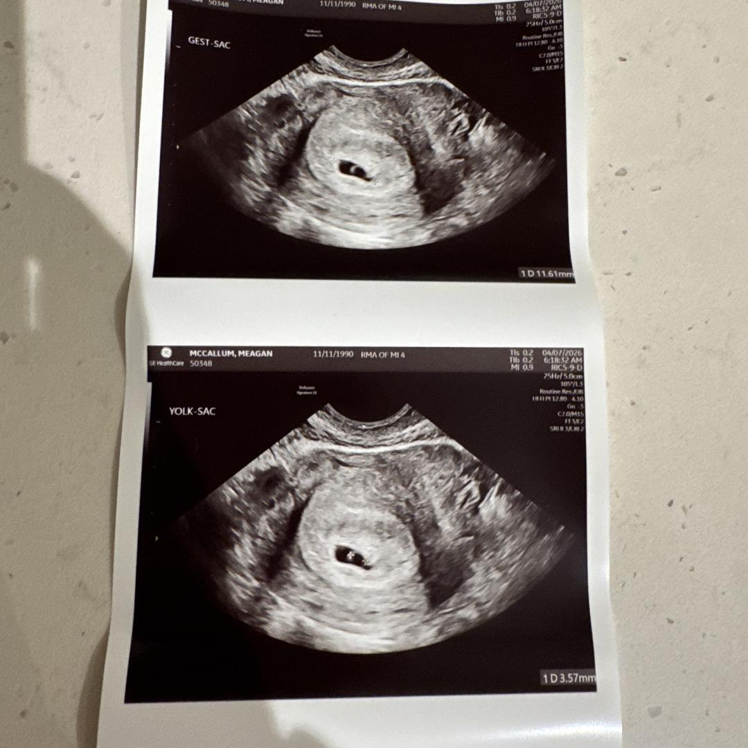 Photo shared by Meagan for their Babylist baby registry.