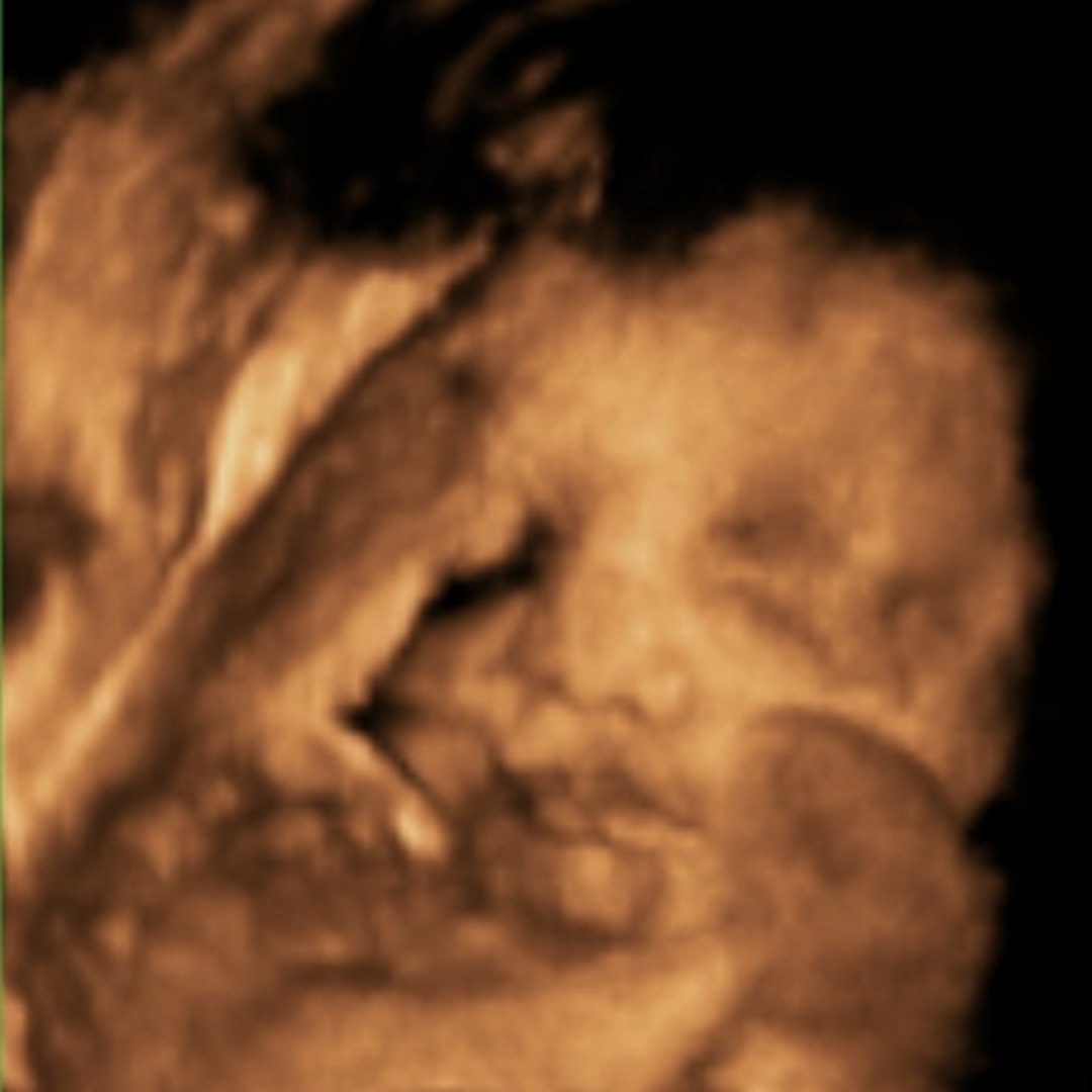 Photo shared by Isabella Raye for their Babylist baby registry.