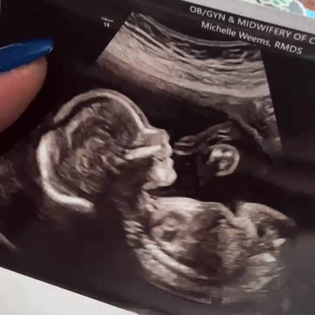 Photo shared by Katie for their Babylist baby registry.
