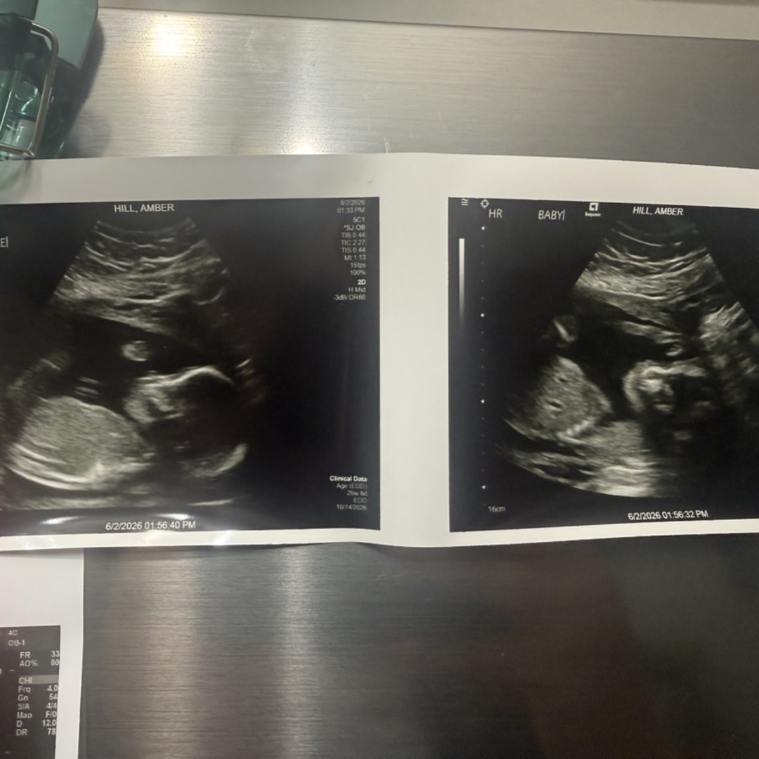 Photo shared by Amber for their Babylist baby registry.